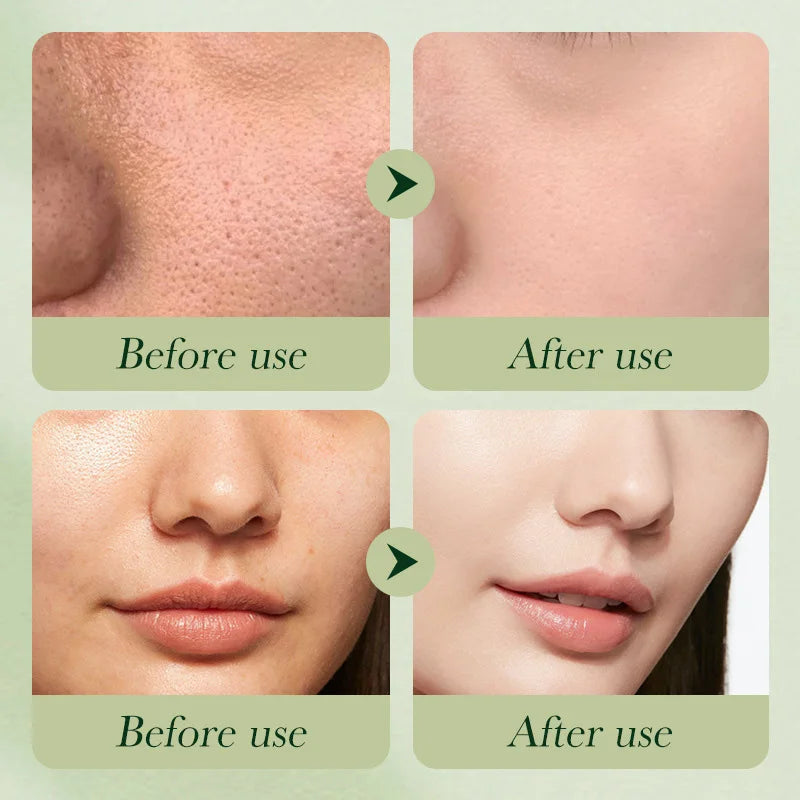 Avocado 6-Piece Skincare Set